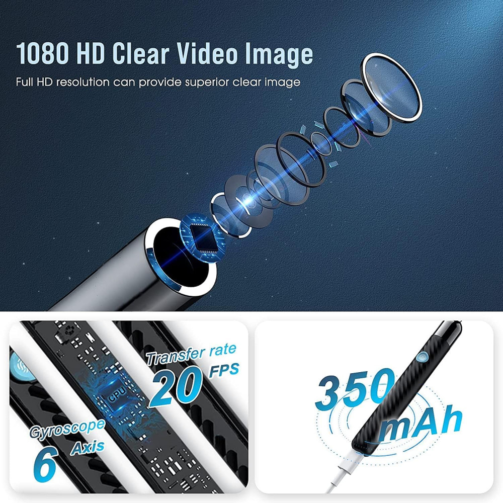 Отоскоп Набор для удаления ушной серы с камерой 1080P