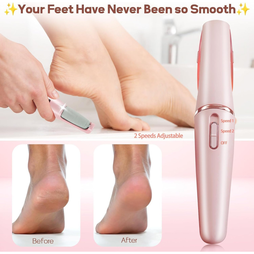Электрическая пемза для ног Nuve Smooth Pedicure Wand с 2 роликами