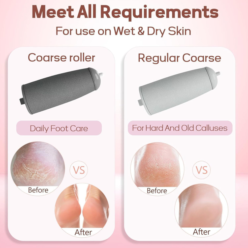 Электрическая пемза для ног Nuve Smooth Pedicure Wand с 2 роликами