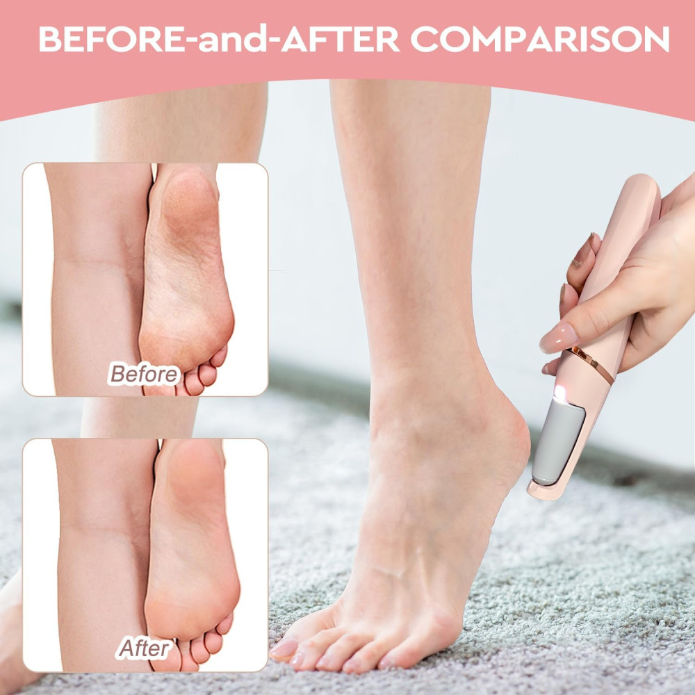 Электрическая пемза для ног Nuve Smooth Pedicure Wand с 2 роликами