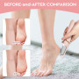 Электрическая пемза для ног Nuve Smooth Pedicure Wand с 2 роликами