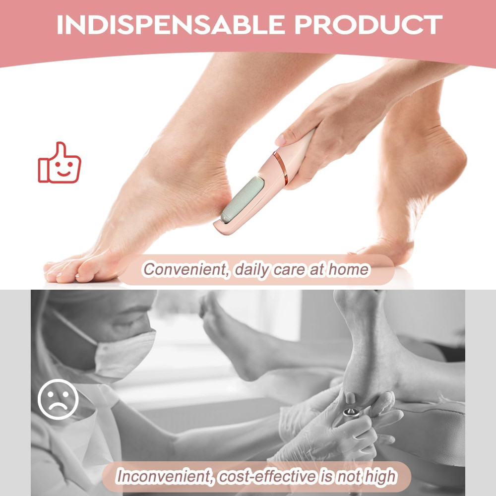 Электрическая пемза для ног Nuve Smooth Pedicure Wand с 2 роликами