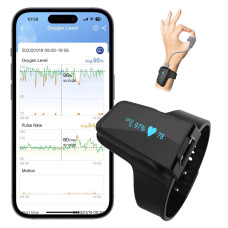 Пульсоксиметр на запястье ViATOM Checkme O2 мониторинг сердечного ритма